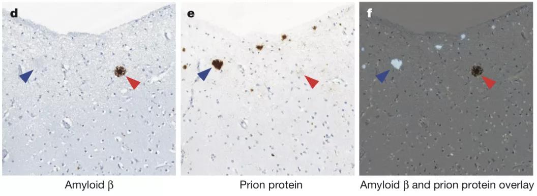 ͼ2���׶ش�ѧѧԺ��UCL����Լ���������棨John Collinge�������ڿ����ϲ��������ڷ����˦µ��������װ߿飨��ɫ��ͷ�����ò����߿�������ɫ��ͷ�����